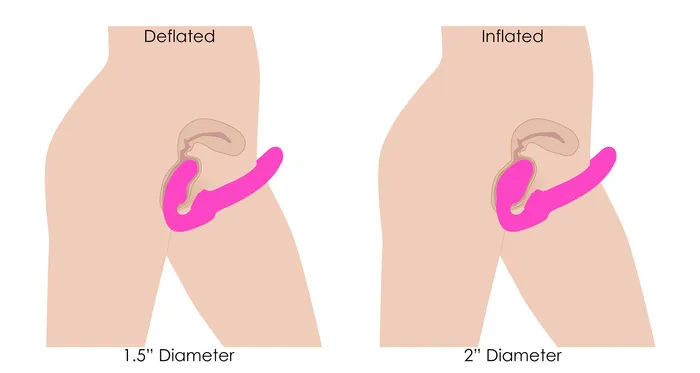 Strap U Female Sex Toys Worlds First Remote Control Inflatable Vibrating Silicone Ergo Fit Strapless StrapOn